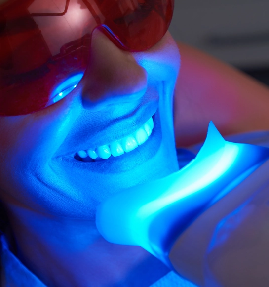 Teeth Whitening