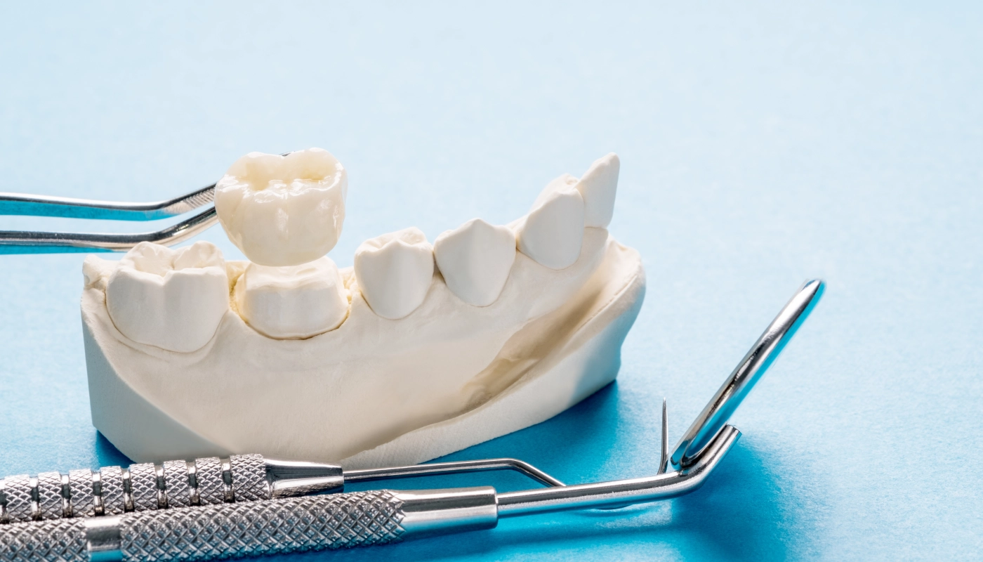 Dental Crowns & Bridges in Goldsboro nc