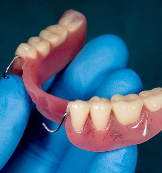 Partial Denture