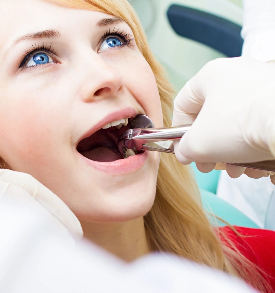 Tooth Extraction