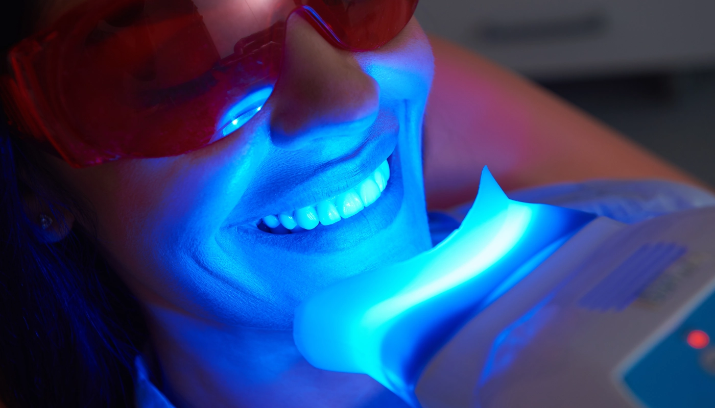 Teeth Whitening in Goldsboro, NC